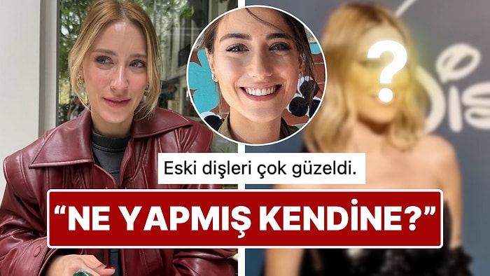 Yüzündeki Değişiklikle Son Hali Dikkat Çeken Hazal Kaya'nın Dişlerine Yaptırdığı İşlem Sınıfta Kaldı