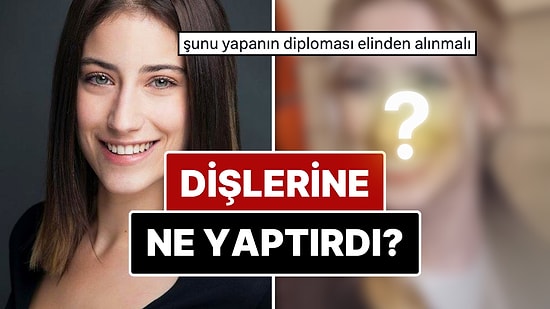 Diş Estetiğinin Ardından Dillere Büyük Düşen Hazal Kaya'nın Yaptırdığı İşlemleri ve Değişimini İnceliyoruz!