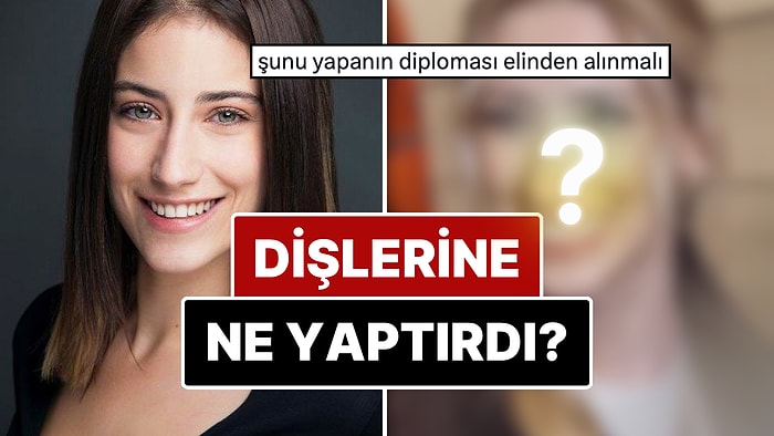 Diş Estetiğinin Ardından Dillere Büyük Düşen Hazal Kaya'nın Yaptırdığı İşlemleri ve Değişimini İnceliyoruz!