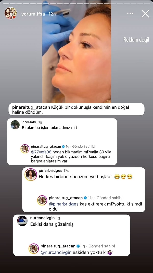 Yıllardır seyrek kaşlarıyla uğraştığını, artık yüzüne tam oturan, daha belirgin kaşlara kavuştuğunu söyleyen Altuğ yorumlara da yanıt verdi.