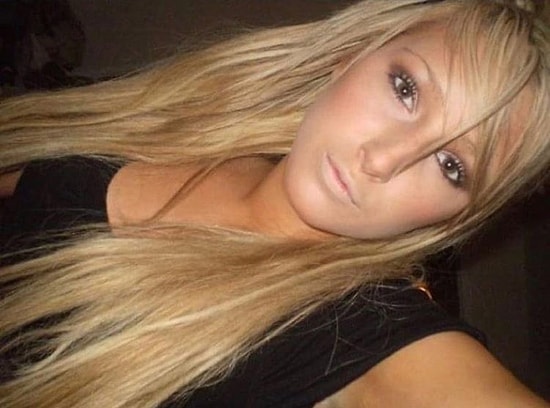 Woman Shares Pre-Surgery Photos, Prompting “Why Did You Do This to Yourself?” Reactions