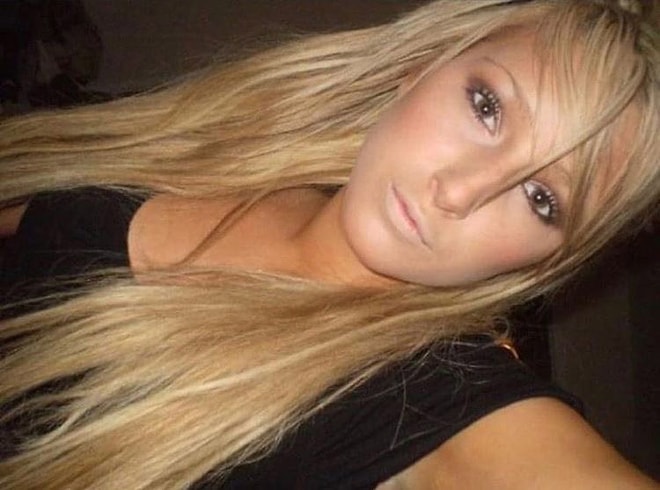 Woman Shares Pre-Surgery Photos, Prompting “Why Did You Do This to Yourself?” Reactions