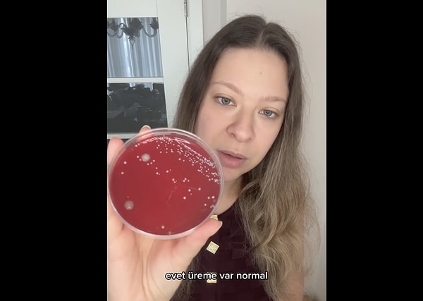 Tırnak altında biriken bakteriler, çeşitli sağlık sorunlarına yol açabiliyor.