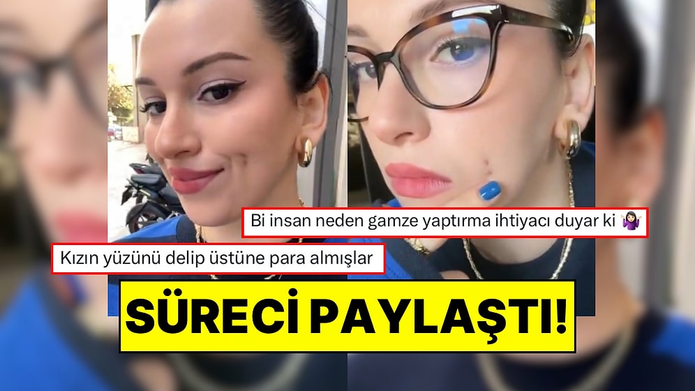 Gamze Estetiği Yaptıran Kadın İyileşme Sürecini Paylaştı: “Yüzünü Delip Para Almışlar”
