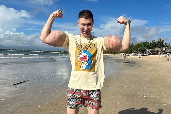 Yıllar süren enjeksiyonlar, geri dönüşü zor bir noktaya getirdi.