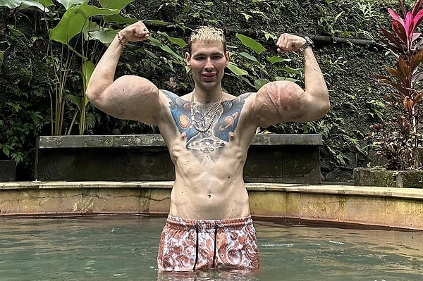 Enfeksiyon ilerledi, doktorlar müdahaleyi ertelemek zorunda kaldı.