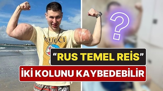 "Rus Temel Reis" İki Kolunu Kaybedebilir: Enjekte Ettiği Kimyasallar Hayatını Kararttı