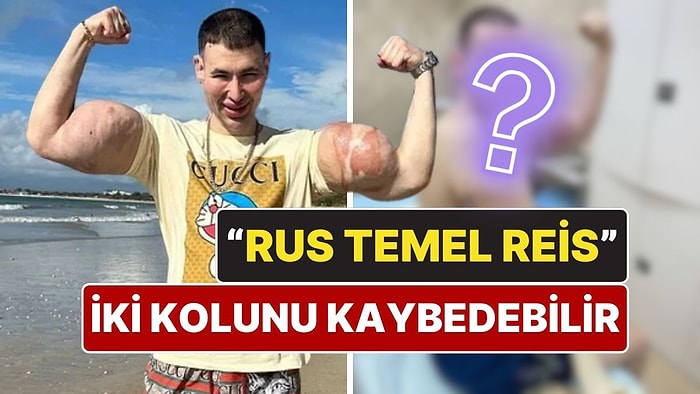 "Rus Temel Reis" İki Kolunu Kaybedebilir: Enjekte Ettiği Kimyasallar Hayatını Kararttı