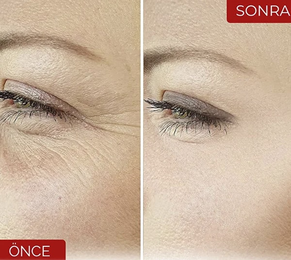 Göz çevresi, kaz ayağı ve alın çizgilerini fark edenlere: DEVIDA Yaşlanma Karşıtı Kolajen Serum Kırışıklık Önleyici, Botox Etkili Vega Series A230