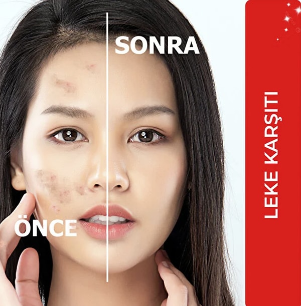 Özellikle leke sorunu yaşayanlar için geliştirilmiş: DEVIDA Leke Karşıtı Aydınlatıcı Canlandırıcı Serum BrightFix Series A200