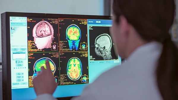 Beyin gelişimi beş ana döneme ayrılıyor ve dört kritik yaşta yön değiştiriyor.