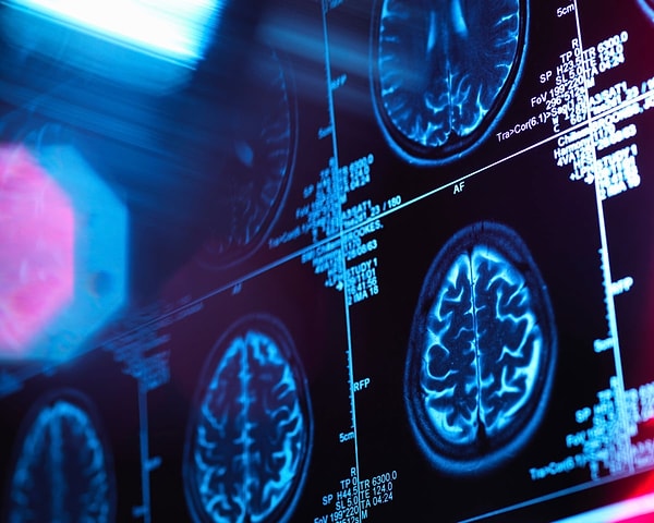 The brain stabilizes after the age of 32, and from 66 onwards, it begins to decline.