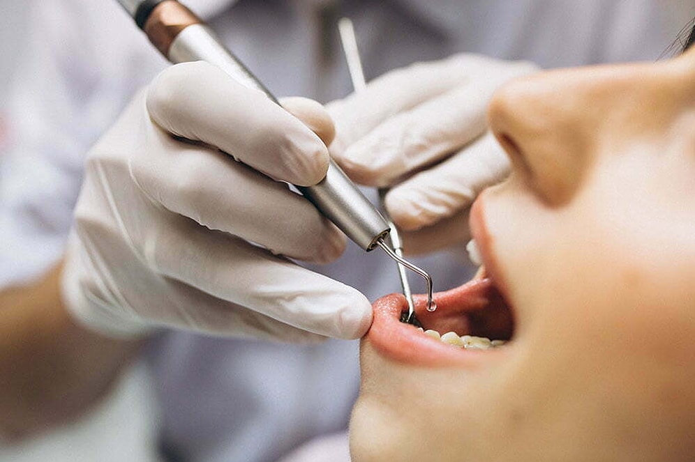 USA Today in the U.S. Recommends Turkey for Those Wanting Dental Work