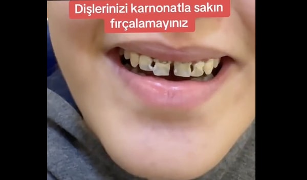 Neden dişler karbonatla fırçalanıyor?