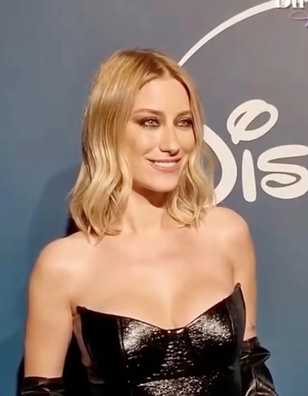 Hazal Kaya Diş Estetiğiyle Gündem Oldu