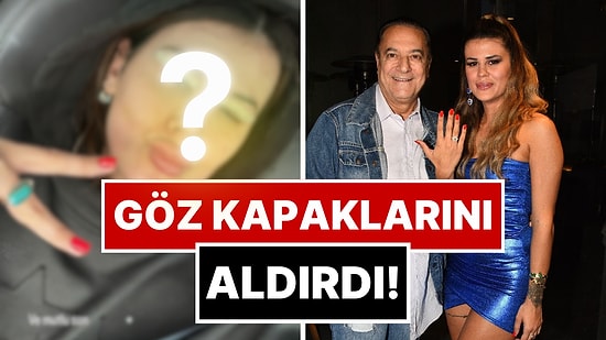 Muradına Erdi: Mehmet Ali Erbil'İn Kendisinden 40 Yaş Küçük Eşi Gülseren Ceylan Estetik Yaptırdı!