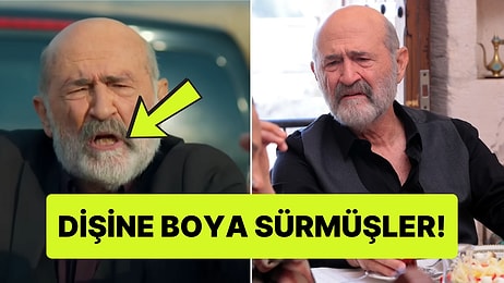 Uzak Şehir'de Ecmel'in Dişlerinin Nasıl Bu Kadar Sarı Olduğuna Diş Hekimi Açıklaması