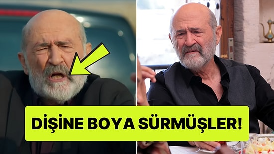 Uzak Şehir'de Ecmel'in Dişlerinin Nasıl Bu Kadar Sarı Olduğuna Diş Hekimi Açıklaması