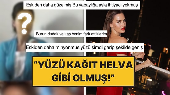 Fahriye Evcen'in Yıllar Önceki Görüntüleri "Estetik" Tartışmasını Tekrar Alevlendirdi