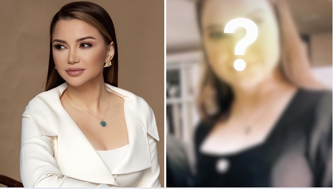 Filtered vs. Unfiltered: Esra Ezmeci’s Photoshop-Free Look Revealed!