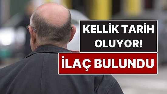 Kellik Tarih Olabilir! Erkek Tipi Kellik İçin Çığır Açan İlaç Bulundu