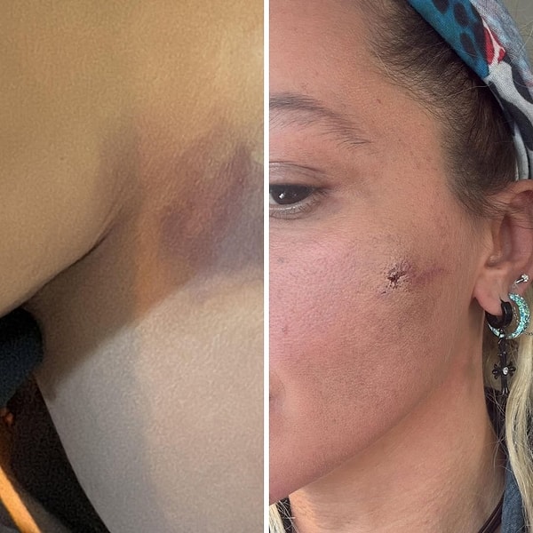 Yıldız Asyalı, bir saat önce yüzünün ve boynunun fotoğrafını paylaşarak eşi tarafından darp edildiğini duyurdu.