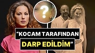 7 Ay Önce Evlenen Yıldız Asyalı, Eşi Tarafından Darp Edildiğini Duyurdu ve Fotoğraflarını Paylaştı!