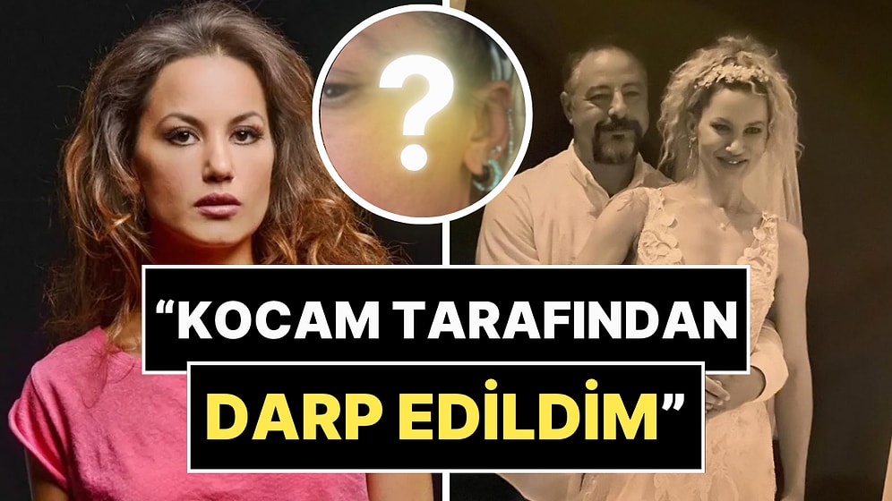 7 Ay Önce Evlenen Yıldız Asyalı, Eşi Tarafından Darp Edildiğini Duyurdu ve Fotoğraflarını Paylaştı!