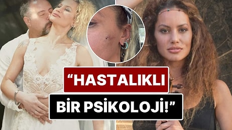 7 Ay Önce Evlendiği Mustafa Semih Demirci'den Şiddet Gördüğünü İddia Eden Yıldız Asyalı Yaşadıklarını Anlattı