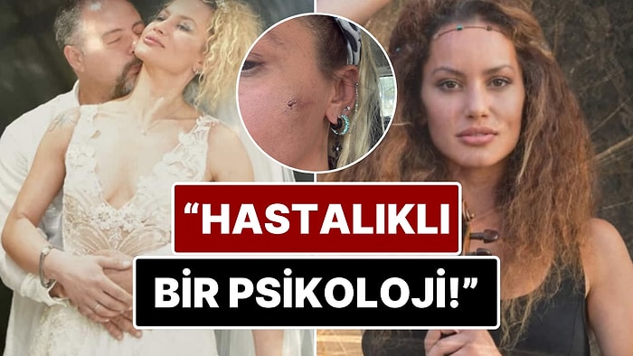 7 Ay Önce Evlendiği Mustafa Semih Demirci'den Şiddet Gördüğünü İddia Eden Yıldız Asyalı Yaşadıklarını Anlattı