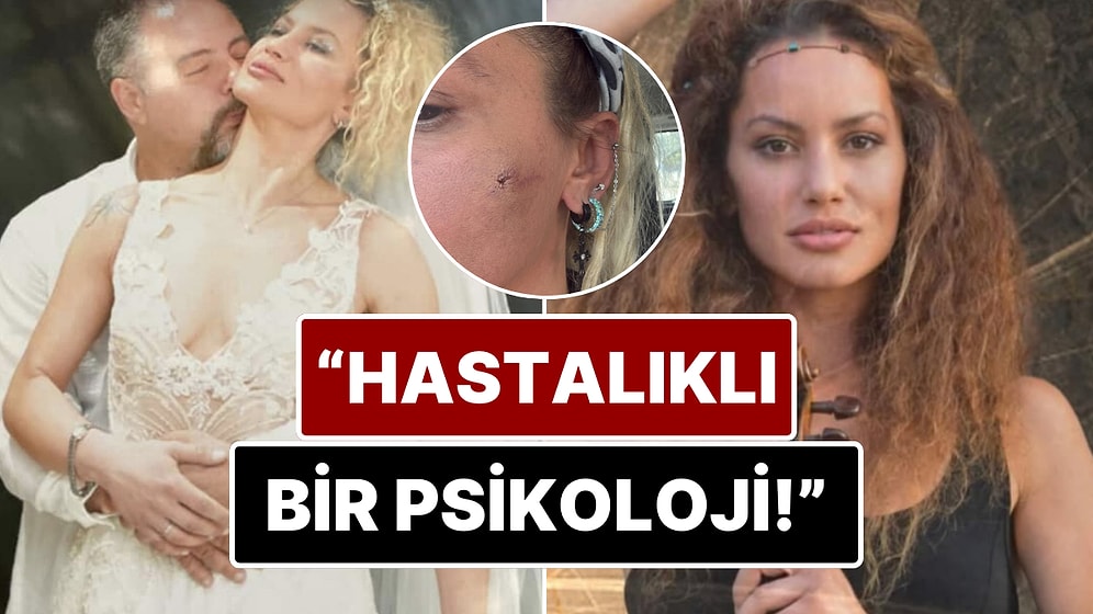 7 Ay Önce Evlendiği Mustafa Semih Demirci'den Şiddet Gördüğünü İddia Eden Yıldız Asyalı Yaşadıklarını Anlattı