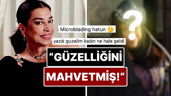 Yeşilçam'ın Usta İsmi Selma Güneri'nin Son Hali Botoks Tartışmalarını Alevlendirdi