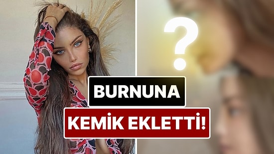 Cinsiyet Geçiş Ameliyatıyla Konuşulan Beren Güney Estetik Operasyonla Burnuna Kemer Ekletti!