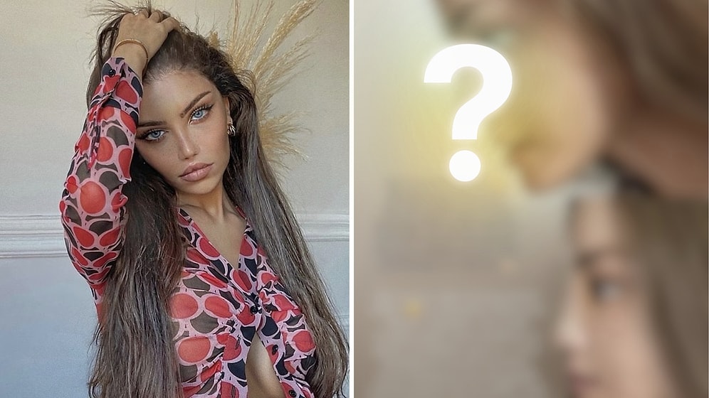 Beren Güney, Gets Nose Surgery With Bone Graft