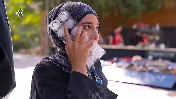 MasterChef 2024'te yarışan Beyza Huri Aydın'ın yüzüne kızgın yağ gelmişti.