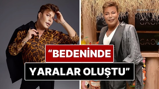 Yaklaşık 2 Aydır Yoğun Bakımda Tedavi Gören Fatih Ürek'in Bedeninde Yaralar Oluştu