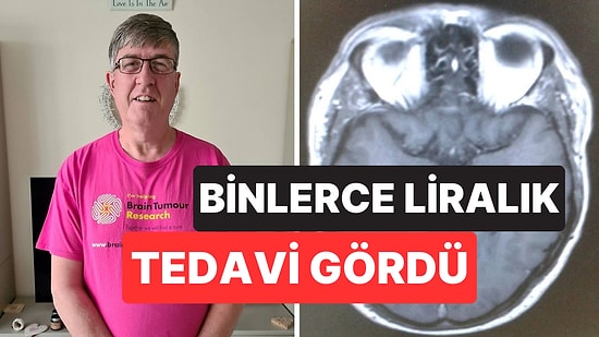 Yıllar Boyunca Basit Bir Kulak Çınlaması Sanıyordu: 59 Yaşındaki Adama Beyin Tümörü Teşhisi Kondu