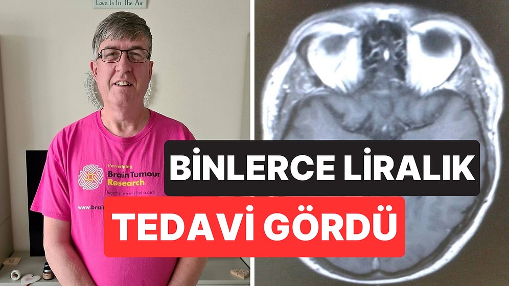 Yıllar Boyunca Basit Bir Kulak Çınlaması Sanıyordu: 59 Yaşındaki Adama Beyin Tümörü Teşhisi Kondu
