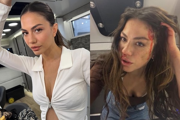 Demet Özdemir, yıllardır her yeni projesiyle oyunculuğunu bir üst seviyeye taşıyarak kendini geliştiriyor.