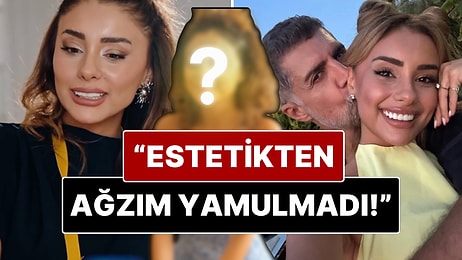Samar Dadgar’dan “Estetik” Yorumlarına Net Yanıt: “Estetiğim Yok, Diş Doktoru Yüzünden”