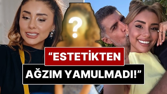 Samar Dadgar’dan “Estetik” Yorumlarına Net Yanıt: “Estetiğim Yok, Diş Doktoru Yüzünden”