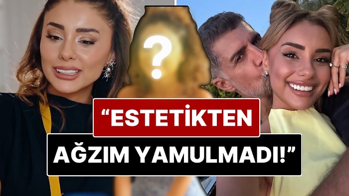 Samar Dadgar’dan “Estetik” Yorumlarına Net Yanıt: “Estetiğim Yok, Diş Doktoru Yüzünden”