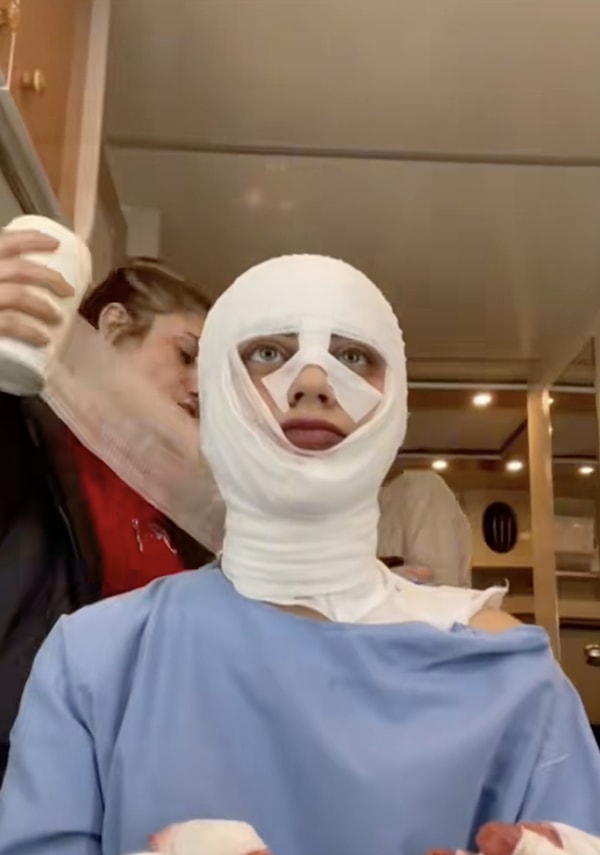 Kızılcık Şerbeti'ndeki yüzü sargılı karakterin Doğa olduğu iddia ediliyor.