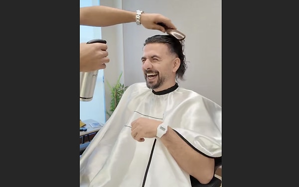 Peki protez saç nedir? Peruktan farkı ne?