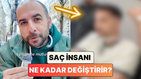 Saç İnsanı Ne Kadar Değiştirir? Sosyal Medya Fenomeni Melih Abuaf Protez Saç Taktırdı