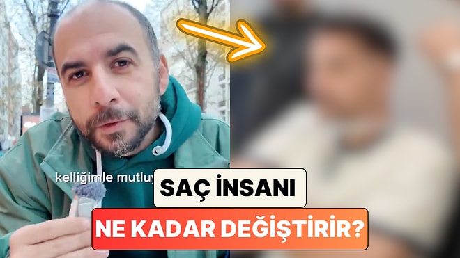 Saç İnsanı Ne Kadar Değiştirir? Sosyal Medya Fenomeni Melih Abuaf Protez Saç Taktırdı