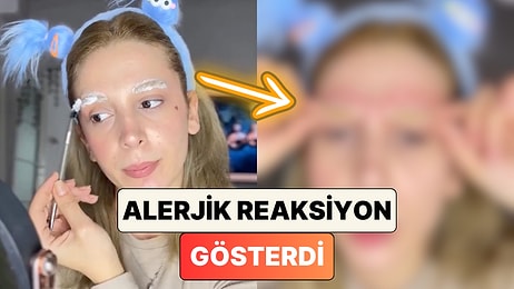 Balon Gibi Sişti: Kaşlarını Beyaz Yapmak İsteyen Bir İçerik Üreticisi Kaşlarının Geldiği Hali Paylaştı