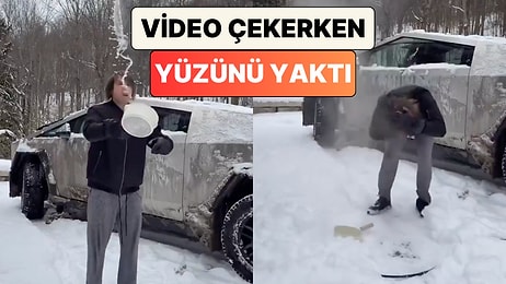 Bir Adam Soğuk Havada Sıcak Suyun Nasıl Kristalleştiğini Göstermek İsterken Yüzünü Yaktı