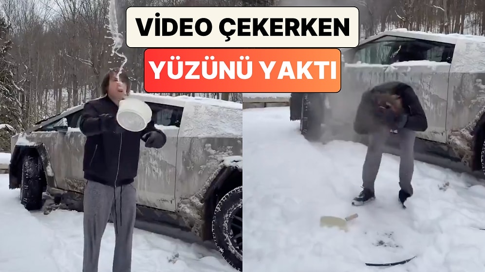 Bir Adam Soğuk Havada Sıcak Suyun Nasıl Kristalleştiğini Göstermek İsterken Yüzünü Yaktı