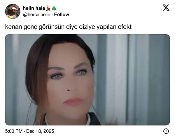 2. Gençleştirme tekniğiyle gençleşmiş işte?